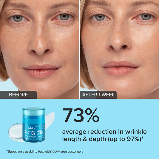 Retinol & Collagen Anti-Aging Face Cream | Hydrating Wrinkle Moisturizer