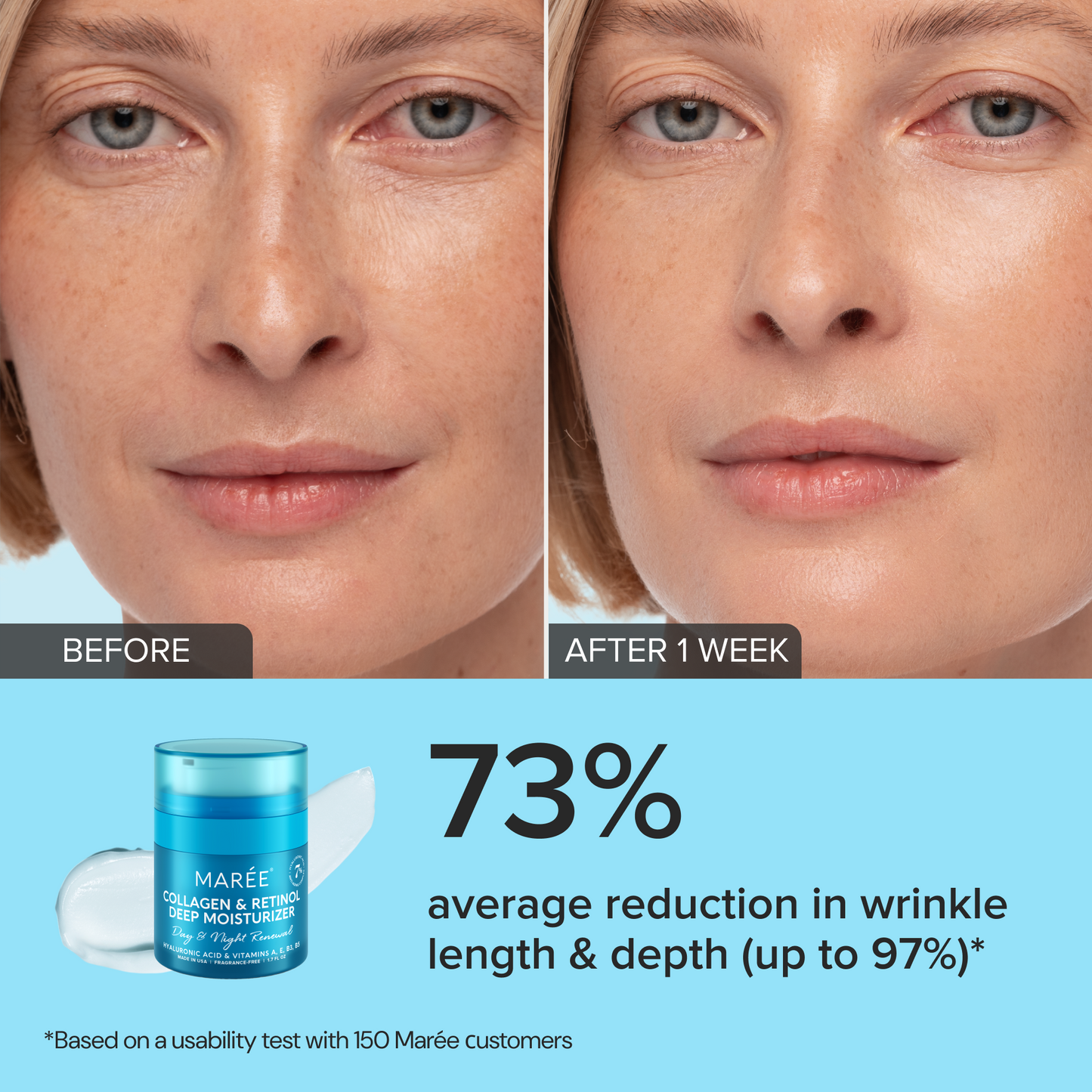 Retinol & Collagen Anti-Aging Face Cream | Hydrating Wrinkle Moisturizer